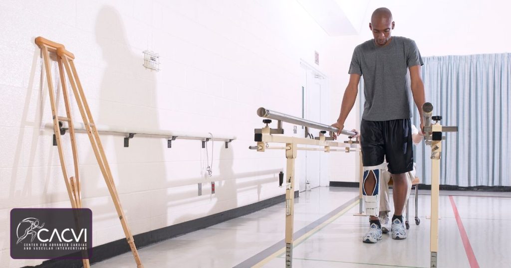 How Long Is Limb Salvage Surgery Recovery? 