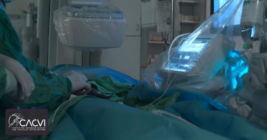 What Are the Different Types of Limb Salvage Surgery? 