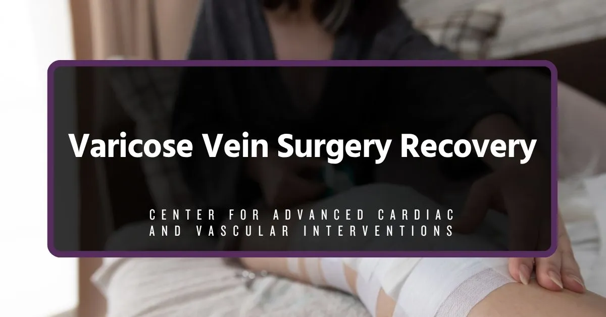 varicose vein surgery recovery varicose vein surgery recovery