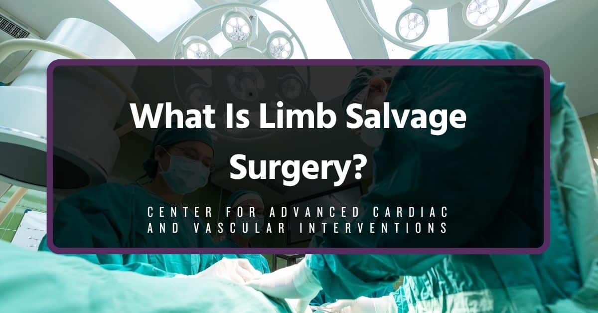 what is limb salvage surgery