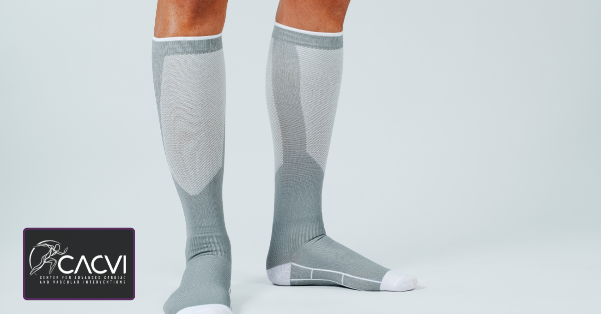 Prolonged standing causing pressure on leg veins and poor circulation